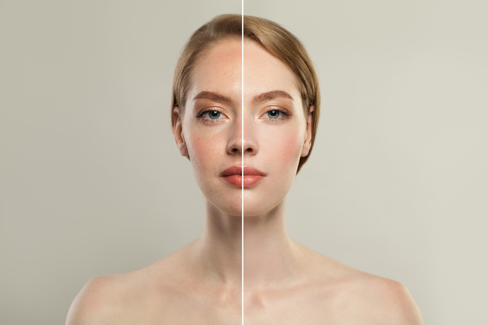 young model woman face with retouching without retouching